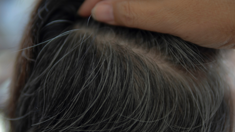 Tóc bạc sau sinh: Nguyên nhân, cách khắc phục và phòng ngừa hiệu quả 3