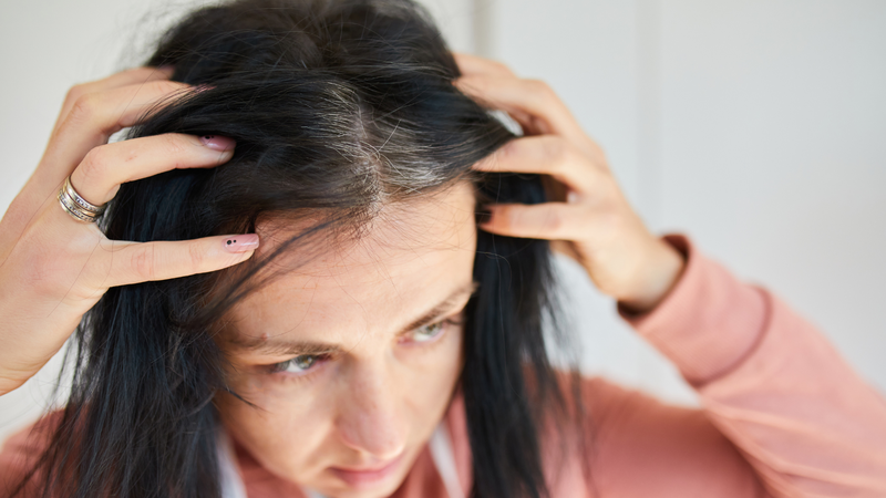 Tóc bạc sau sinh: Nguyên nhân, cách khắc phục và phòng ngừa hiệu quả 4