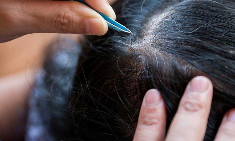 Tóc bạc sớm thiếu chất gì? 3