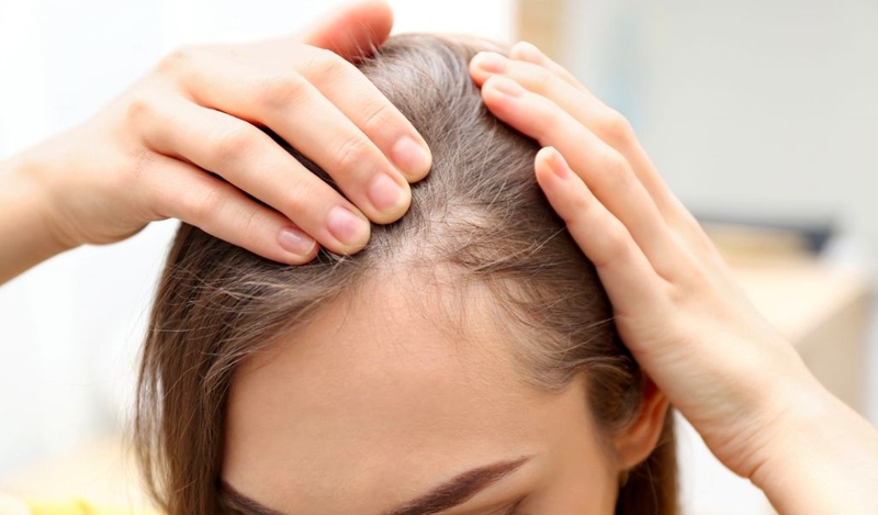 Tóc bò liếm có mọc được không? Có cách khắc phục nhanh chóng, hiệu quả không? 1