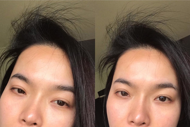 Tóc con mọc lởm chởm do nguyên nhân nào và phải làm sao 3