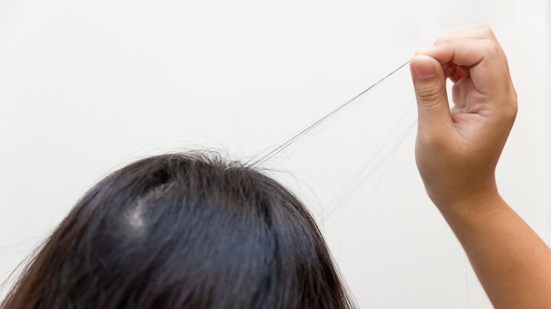Tóc sâu là gì? Tại sao có tóc sâu ngứa, có nên nhổ không? 3