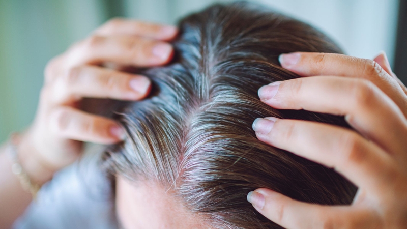 Tóc sâu là gì? Tại sao có tóc sâu ngứa, có nên nhổ không? 4