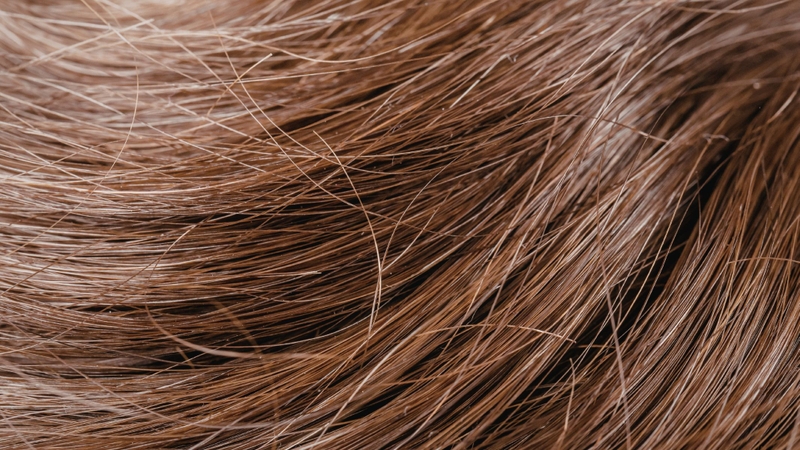 Tóc tơ mỏng, dễ gãy rụng là hệ quả của nhiều yếu tố tác động đồng thời lên nang tóc