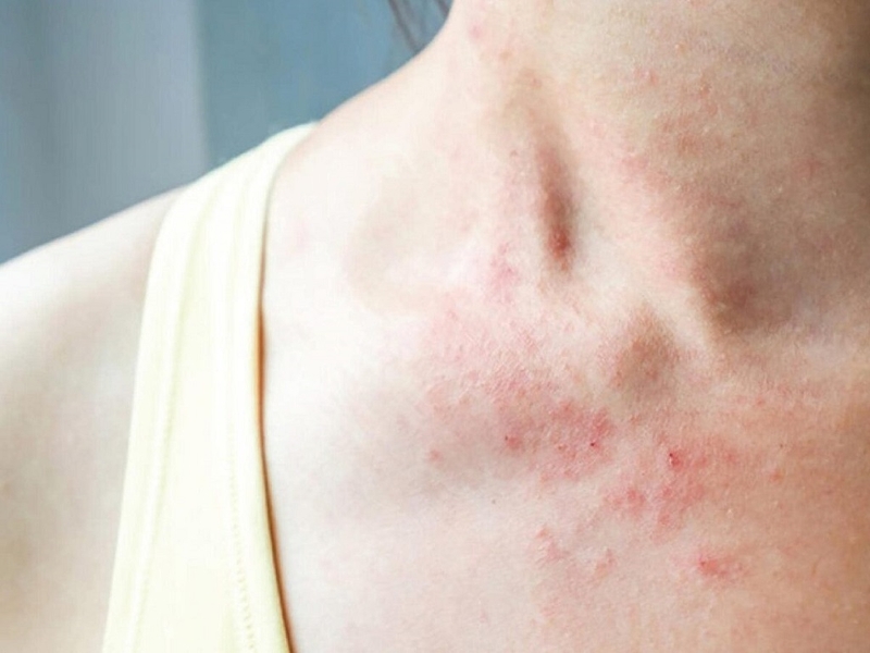 Tomax genta có dùng được cho bà bầu không? Những lưu ý khi sử dụng thuốc 4