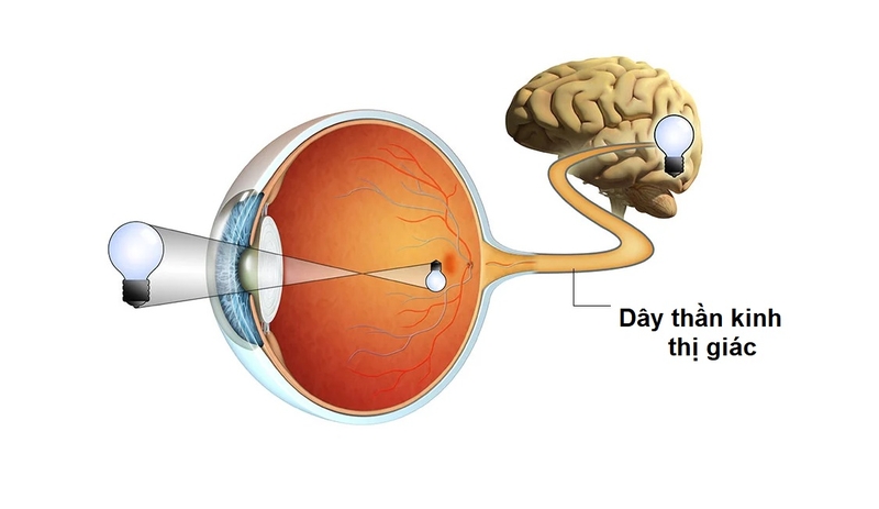 Tổn thương dây thần kinh thị giác: Nguyên nhân, triệu chứng, cách điều trị 1