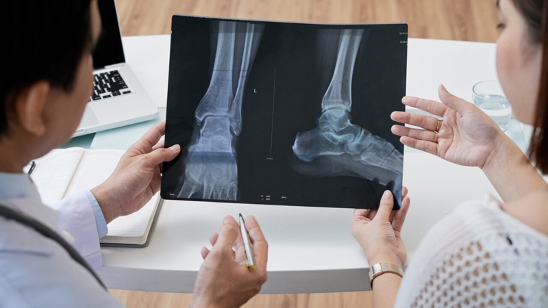 Tổn thương thần kinh mác: Dấu hiệu nhận biết và biện pháp chẩn đoán 3