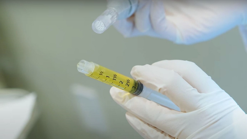 Tổng hợp 5 phương pháp tiêm trẻ hóa vùng cổ 3