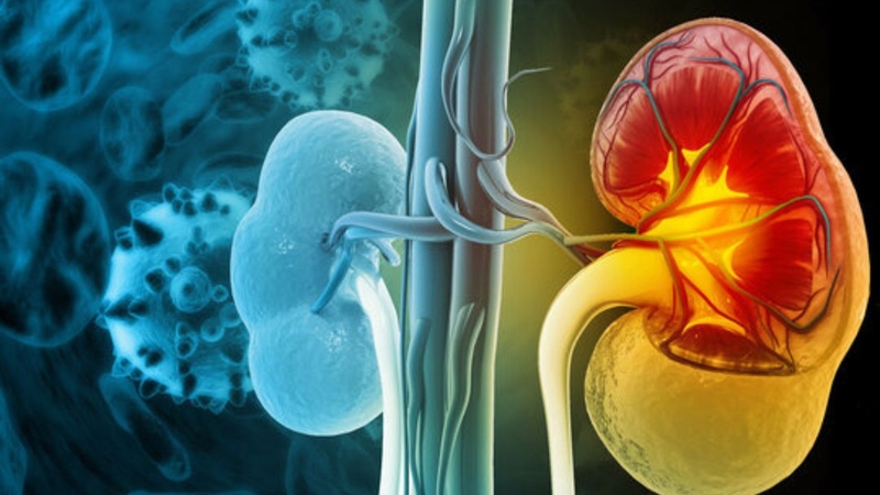 Tổng hợp các biến chứng của lọc màng bụng 1