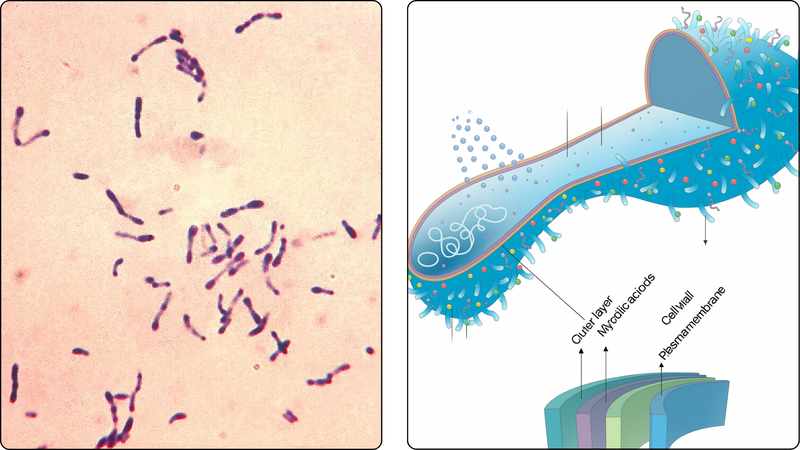 Tổng hợp các hình ảnh bệnh bạch hầu để nhận biết bệnh sớm 1
