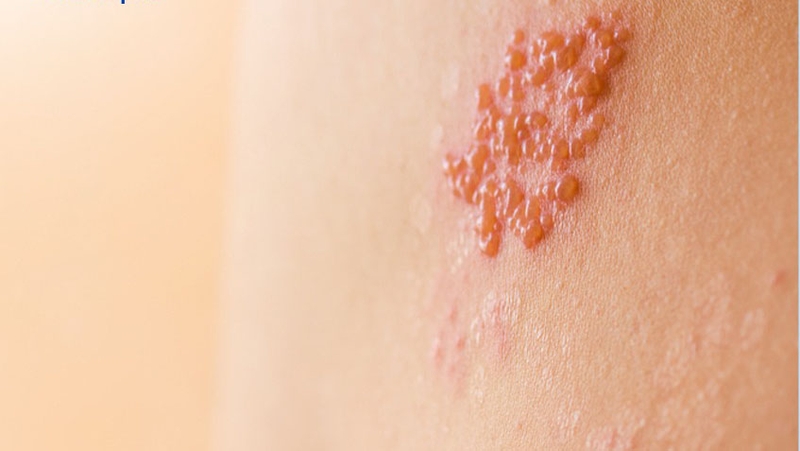 Tổng hợp các vấn đề về da thường gặp nhất ở người lớn 1