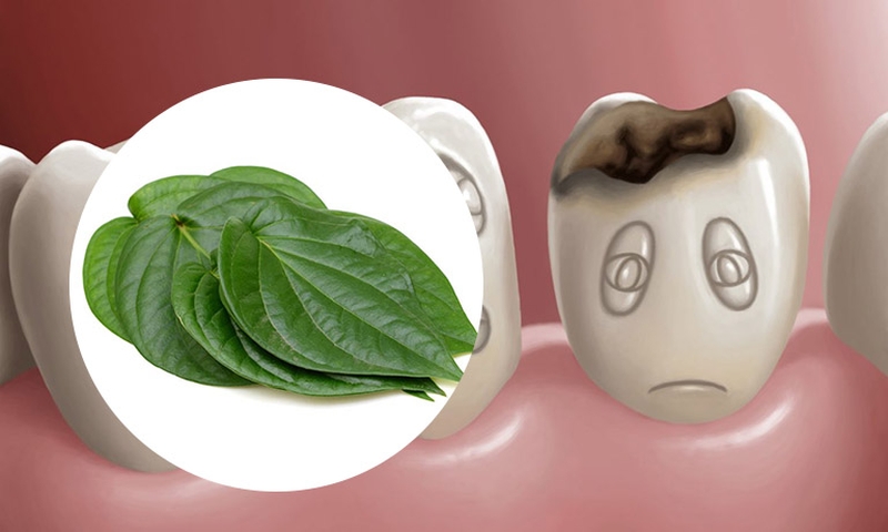 Tổng hợp những cách chữa viêm lợi bằng dân gian an toàn, hiệu quả 2