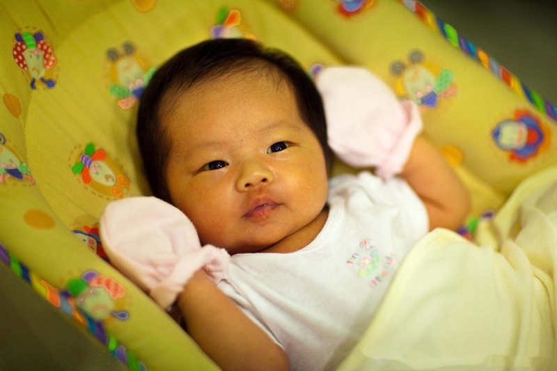 Tổng hợp thông tin về bướu huyết thanh ở đầu trẻ sơ sinh 3