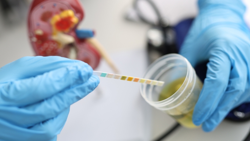 Xét nghiệm tổng phân tích nước tiểu được thực hiện nhằm phát hiện sớm các bất thường liên quan đến hệ tiết niệu