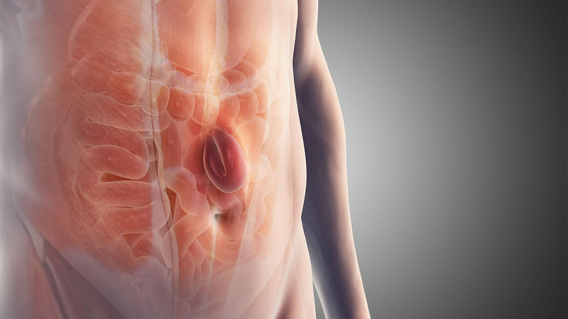 Tổng quan về chứng sa ruột4