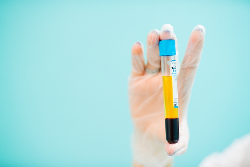 Tổng quan về huyết thanh và huyết tương, cách phân biệt 1