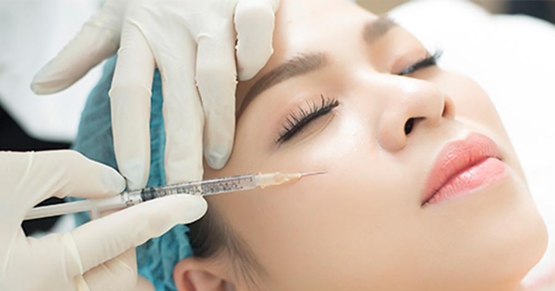 Tổng quan về phương pháp tiêm rãnh cười 3