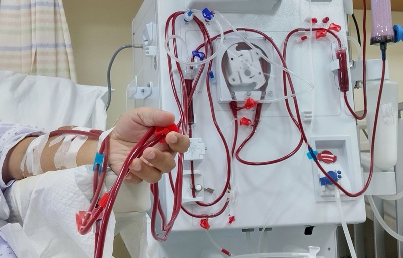 Tổng quan về quy trình chạy thận nhân tạo và lưu ý về kỹ thuật mà người bệnh nên biết 3