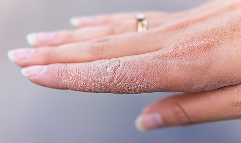 Top 3 kem trị da tay bị khô nứt nẻ được nhiều người dùng 1