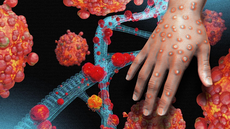 Top 4 loại thuốc điều trị đậu mùa khỉ đang được cân nhắc sử dụng 1