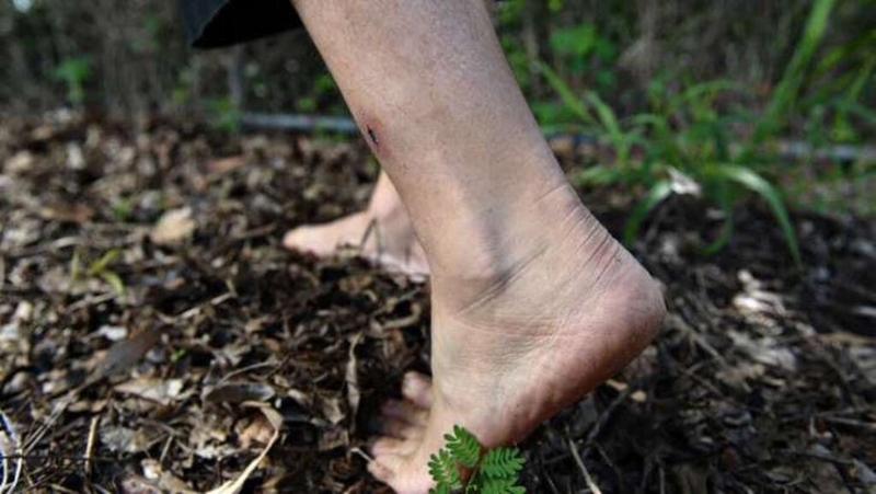 Top 5 cách phòng bệnh Whitmore theo khuyến cáo từ Bộ Y tế 1