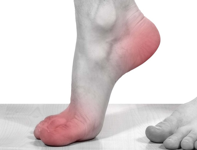 Top 5 loại thực phẩm chức năng giảm acid uric được nhiều người tin dùng hiện nay 1