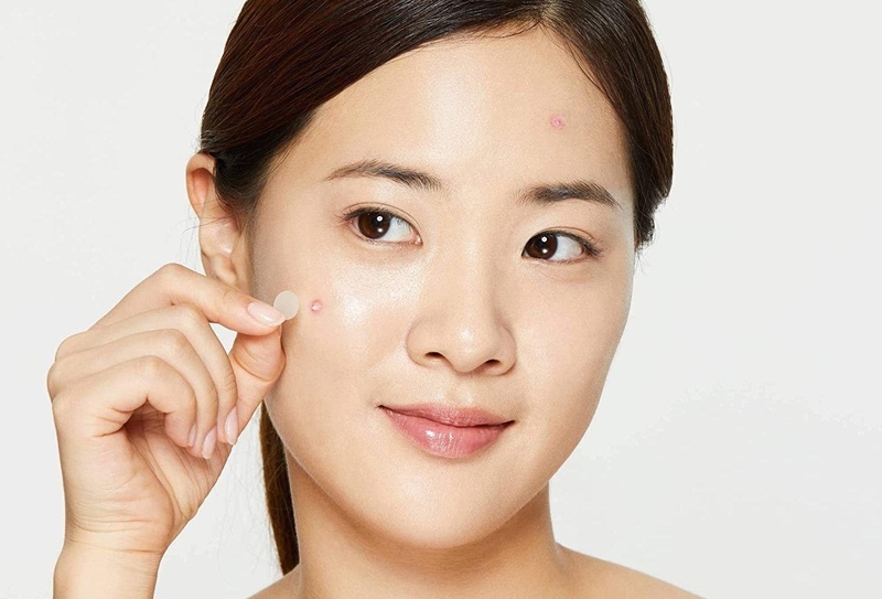Top 5 sản phẩm miếng dán mụn hiệu quả nhất hiện nay 1