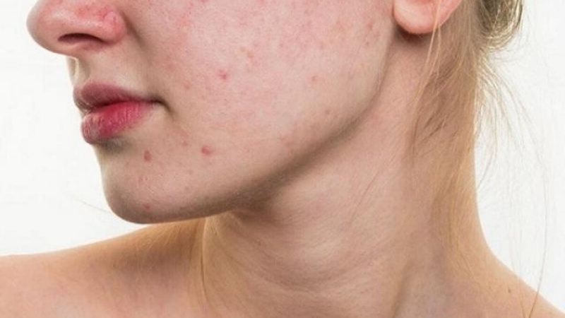 Top 7 các sai lầm khi sử dụng kem dưỡng ẩm cần bỏ ngay 2