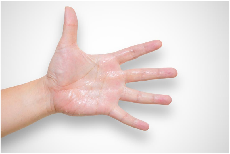 Top 7 cách chữa mồ hôi tay chân hiệu quả nhất 1