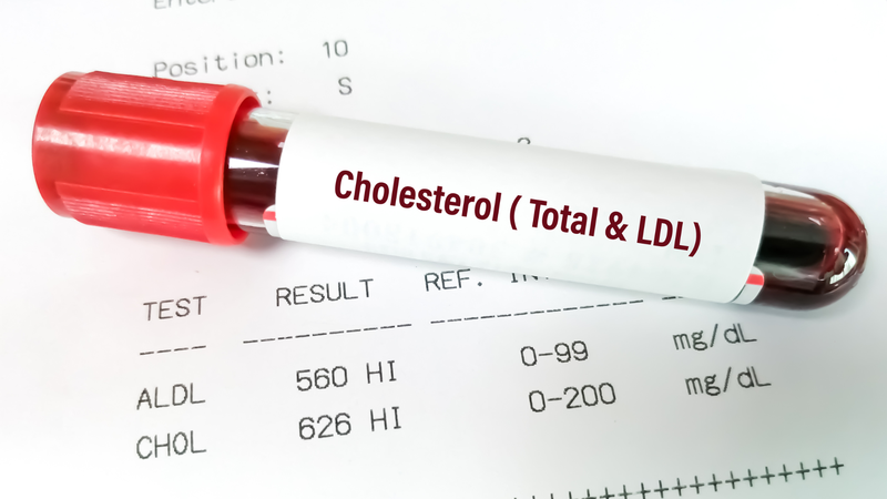 Người cholesterol cao không nên tự ngừng thuốc khi đổi chế độ ăn