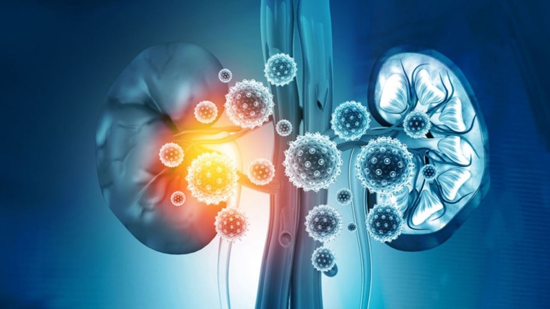 Top các câu hỏi thường gặp liên quan đến bệnh suy thận 2