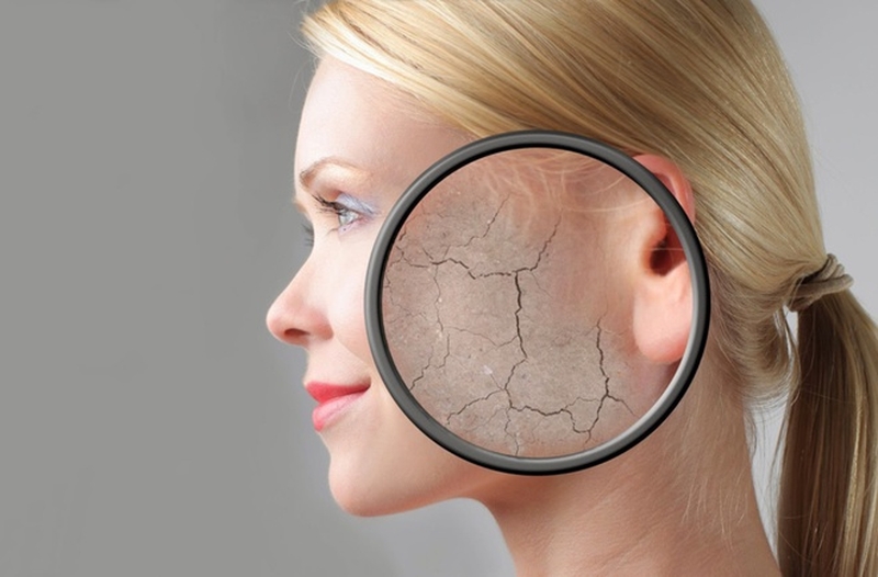 Top kem dưỡng ẩm cho da khô vào mùa hè tốt nhất hiện nay 1