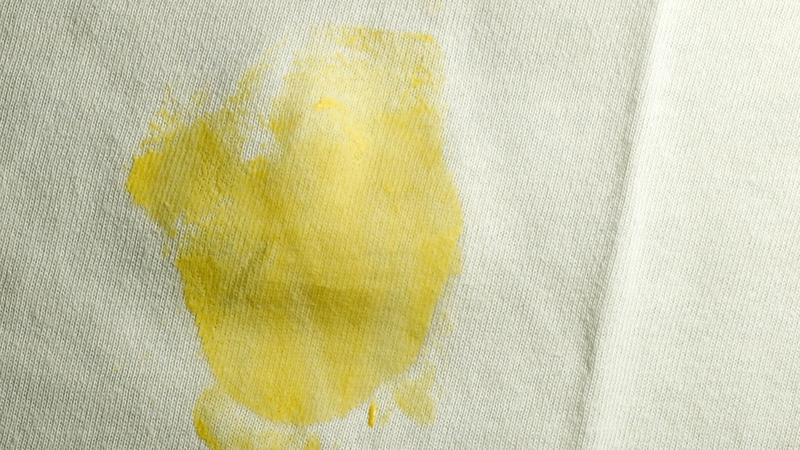 Tình trạng lăn khử mùi để lại vết ố vàng trên áo là hệ quả của các phản ứng hóa sinh