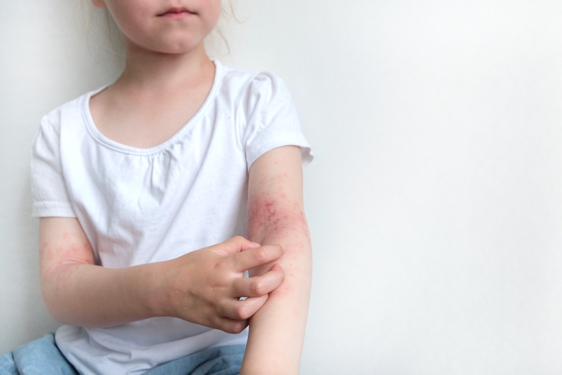 Top những cách làm sạch da cho trẻ bị viêm da cơ địa3