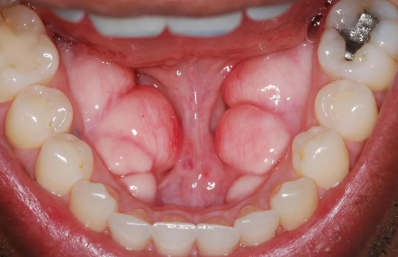 Torus là gì? Những điều bạn cần biết về Torus 1