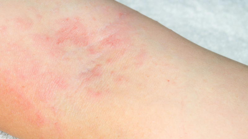 Trà detox: Liệu có hiệu quả như lời đồn? 5