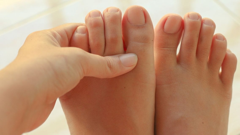 Ngón chân sưng đau, biến dạng là dấu hiệu cần được thăm khám sớm