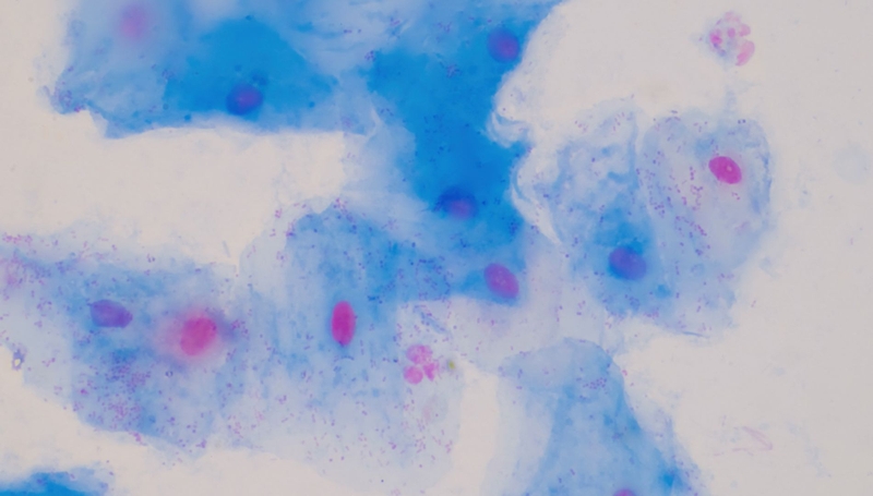 Trà vạn thọ có lợi ích đối với sức khỏe như thế nào? 2