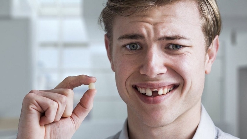 Trám răng cửa bị gãy có đau không? Những điều bạn cần biết 1