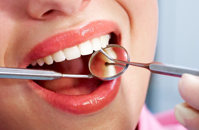 Trám răng là gì? Trám răng có cần chích thuốc tê không 2