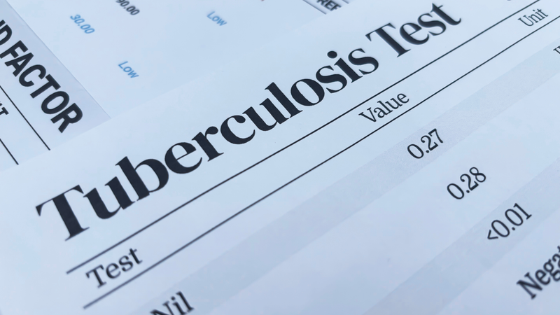 Lao màng bụng là thể ít gặp