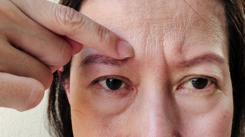 Gân xanh xuất hiện đột ngột, sưng to bất thường