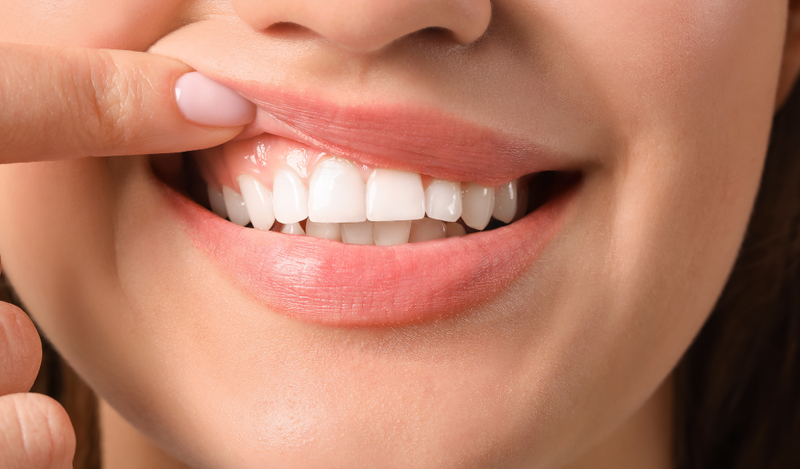 Tráng men răng không làm ảnh hưởng tới sức khỏe răng miệng