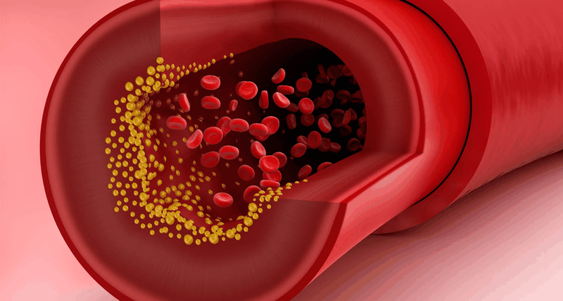 Dùng thuốc tránh thai có thể tăng cholesterol