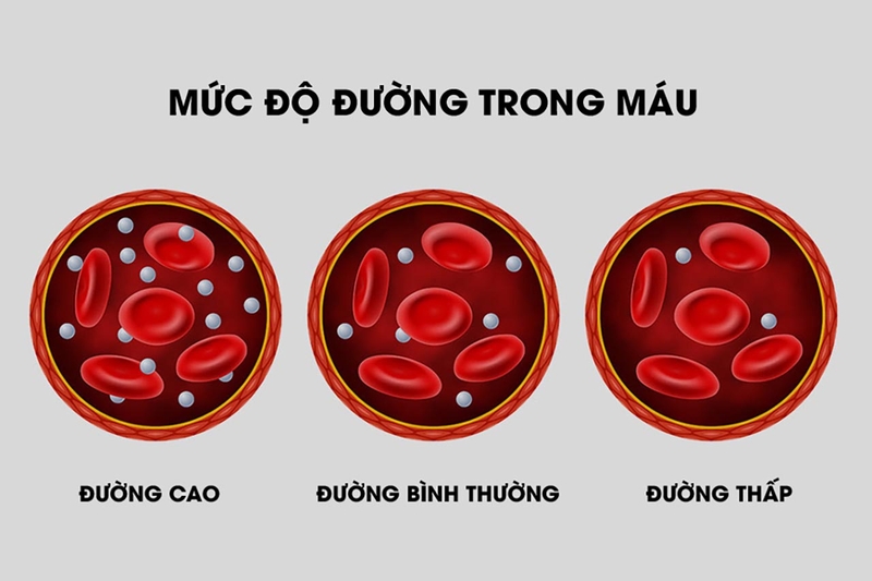 Biến chứng lượng đường máu tăng do người bị tiểu đường uống thuốc tránh thai