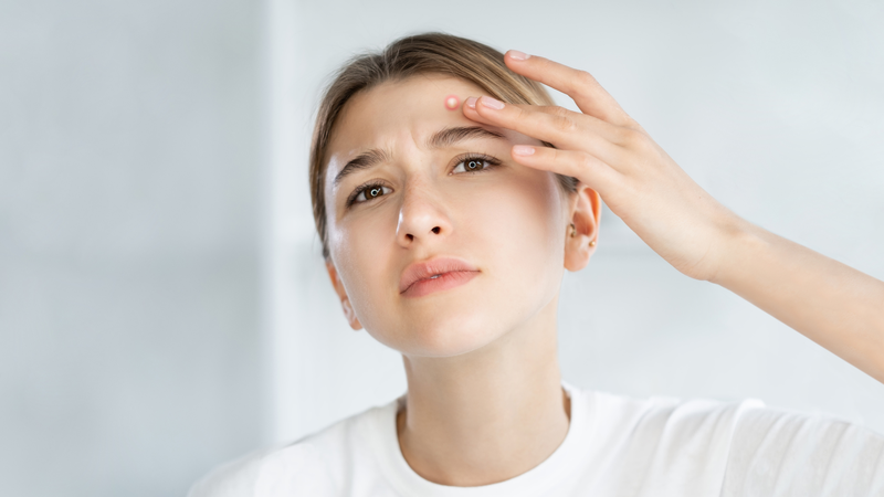 Tránh xa 7 sai lầm sau khi điều trị mụn trứng cá tuổi dậy thì 1