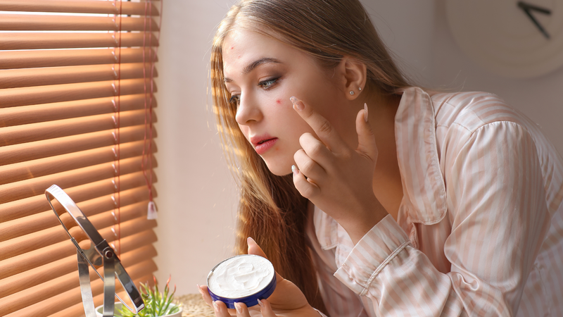 Tránh xa 7 sai lầm sau khi điều trị mụn trứng cá tuổi dậy thì 3