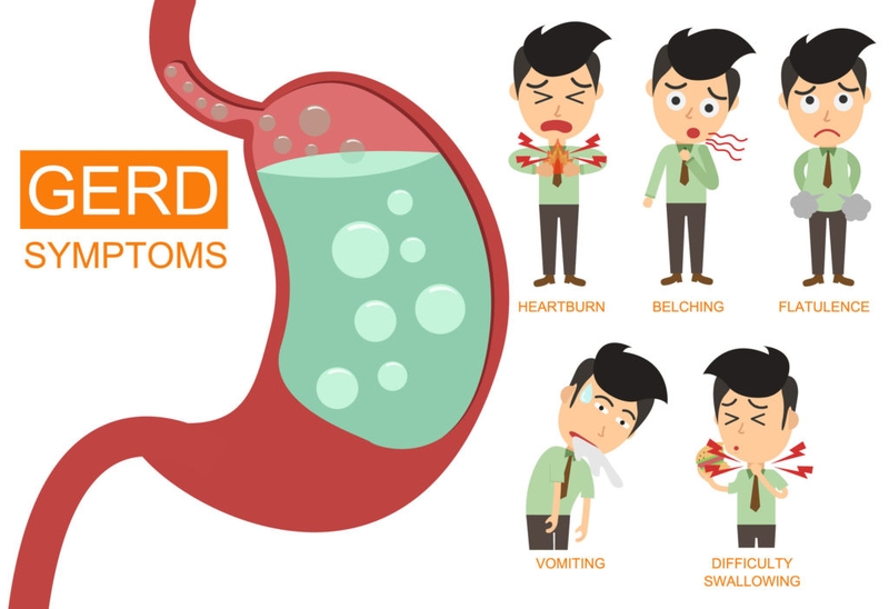 Trào ngược dạ dày độ A có nguy hiểm không? 4