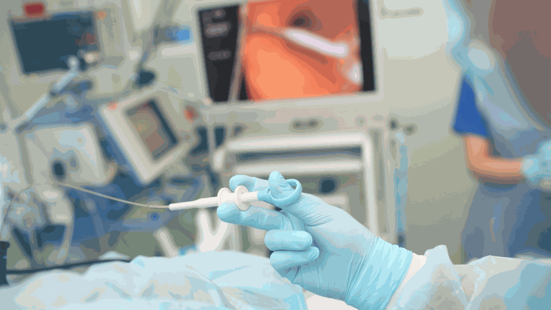 Nội soi dạ dày thực quản là phương pháp giúp các bác sĩ dễ dàng nhận biết bệnh nhân có bị viêm thực quản hay không