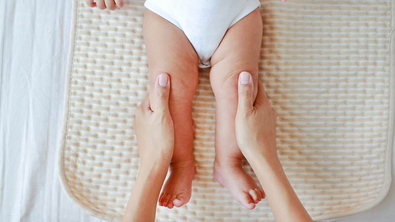Phương pháp điều trị trật khớp gối bẩm sinh là nắn chỉnh và bó bột hàng tuần